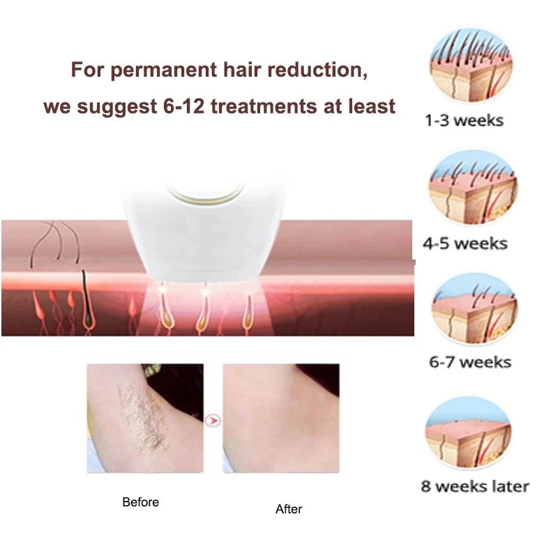 SILKORA™ IPL